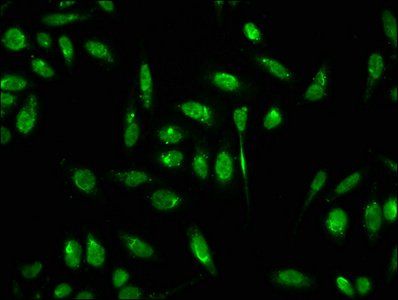 Formyl-HIST1H3A (K18) Antibody