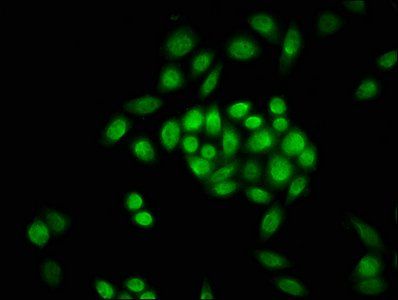 Formyl-HIST1H3A (K23) Antibody