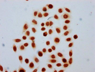 HIST1H4A Antibody