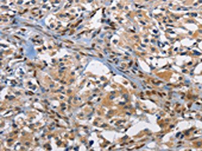 FOS Antibody