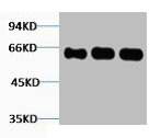 FOS Antibody