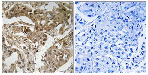 FOS (Phospho-Thr232) Antibody
