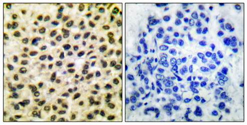 Fos Antibody