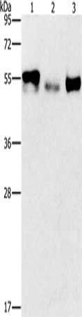FOSB Antibody