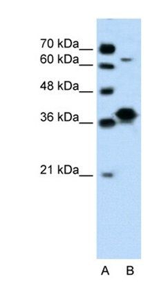 FOSL1 antibody