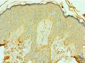 FOSL1 antibody