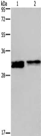 FOSL1 antibody