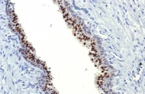 FOXA1 / HNF3A Antibody