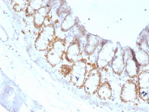 FOXA1 / HNF3A Antibody