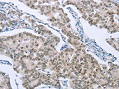 FOXA1 Antibody