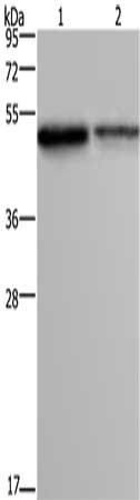 FOXA1 Antibody