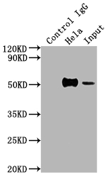 FOXA1 Recombinant Monoclonal Antibody