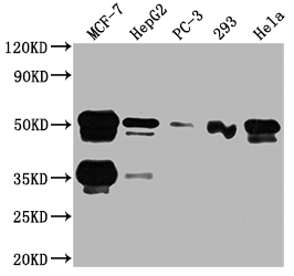 FOXA1 Recombinant Monoclonal Antibody