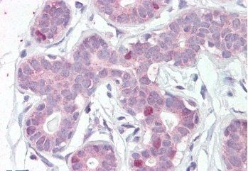 Goat anti-FOXA1 / HNF3A Antibody