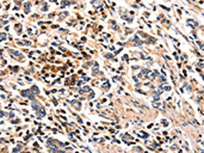 FOXB2 antibody