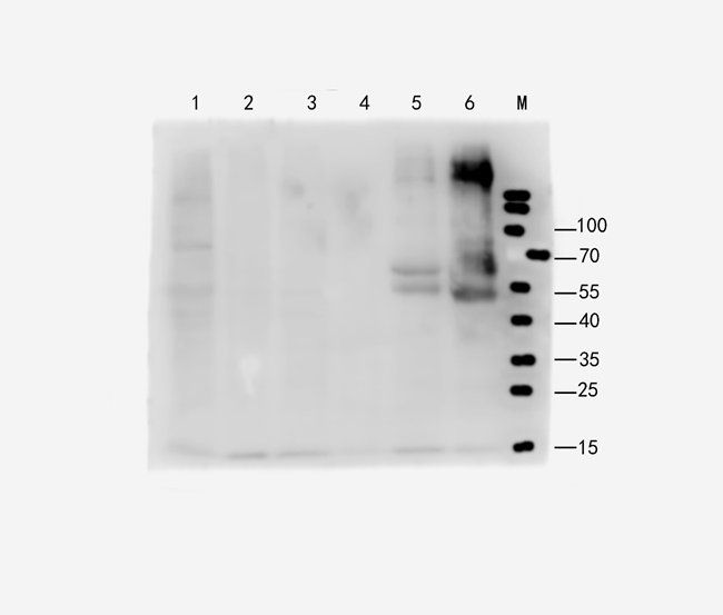 FOXC1 antibody