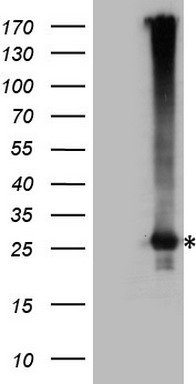 FOXC2 Antibody