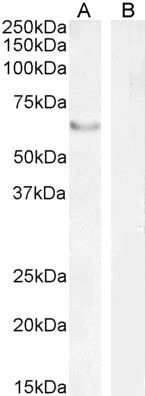 Goat anti-FOXC2 Antibody