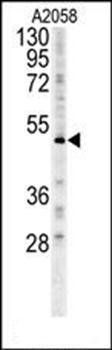 FOXC2 antibody