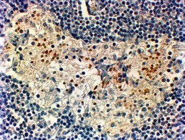 Goat anti-FOXC2 Antibody