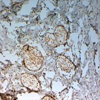 Goat anti-FOXC2 Antibody