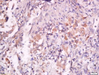 FOXD1 Rabbit Polyclonal Antibody