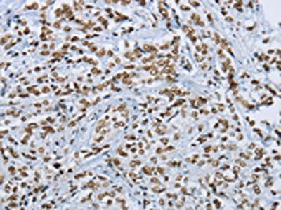 FOXE1 Antibody