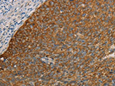 FOXF2 Antibody