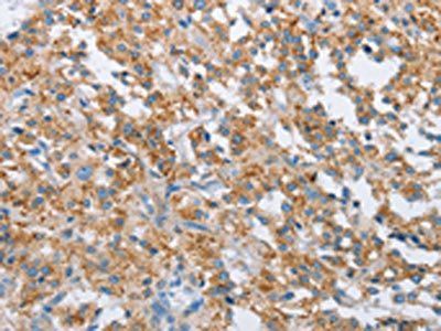 FOXF2 Antibody