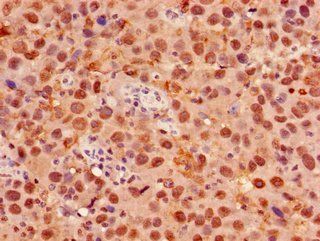 FOXK1 Antibody