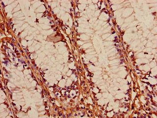 FOXK1 Antibody
