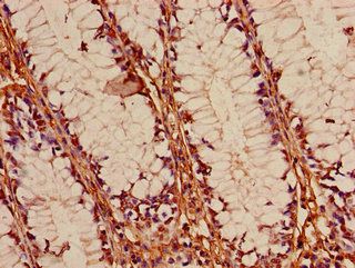 FOXK1 antibody