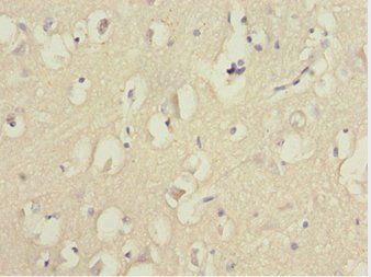 FOXN2 Antibody