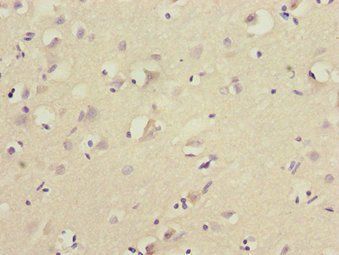 FOXN2 Antibody