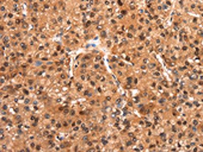 FOXN2 Antibody