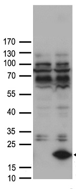 FOXO1 Antibody