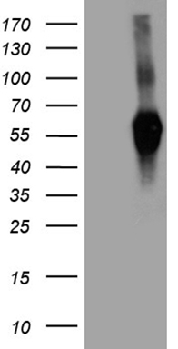 FOXO1 Antibody