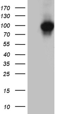 FOXO1 Antibody