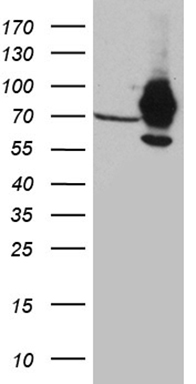 FOXO1 Antibody