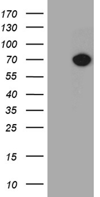 FOXO1 Antibody