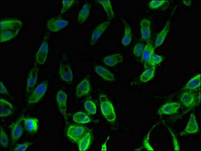 FOXO1 Antibody