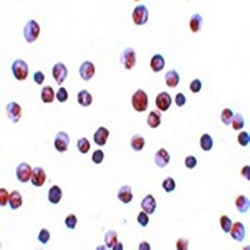 FOXO1 Antibody