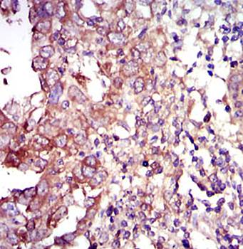 FOXO1 Antibody