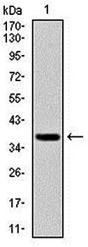 FOXO1 Antibody