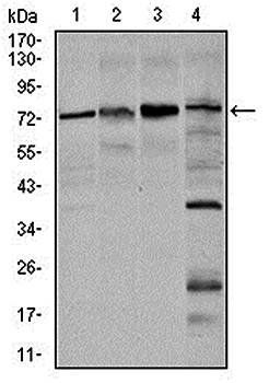 FOXO1 Antibody