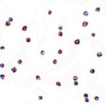 FOXO3 Antibody