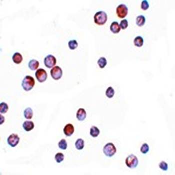 FOXO4 Antibody