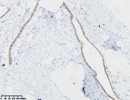 FOXP1 Antibody