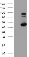 FOXP1 Antibody