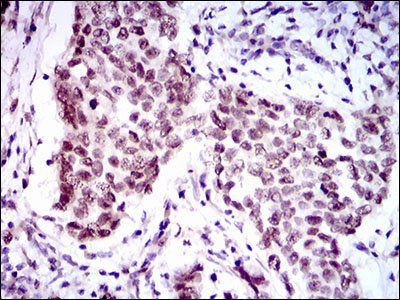 FOXP1 Antibody